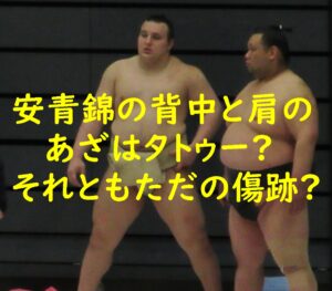 安青錦の背中と肩のあざはタトゥー?それともただの傷跡?